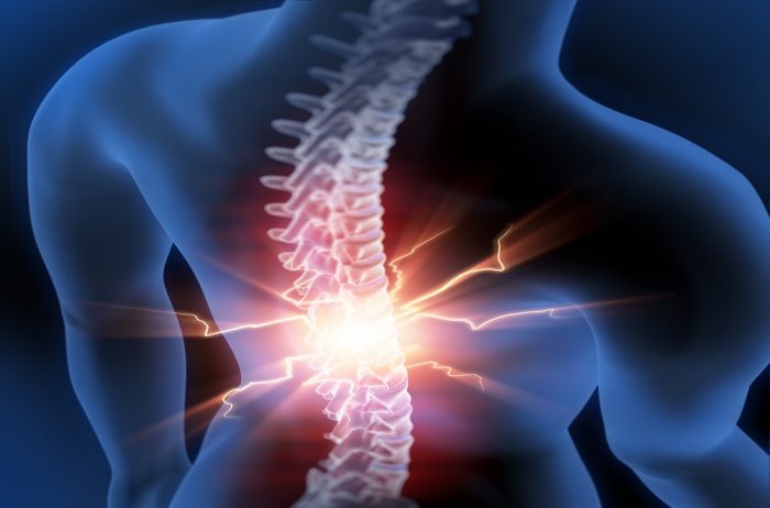 spinal pain cervical lumbar disc Avon Connecticut